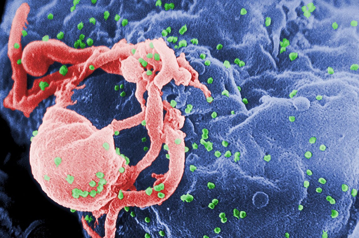 HIV rendering