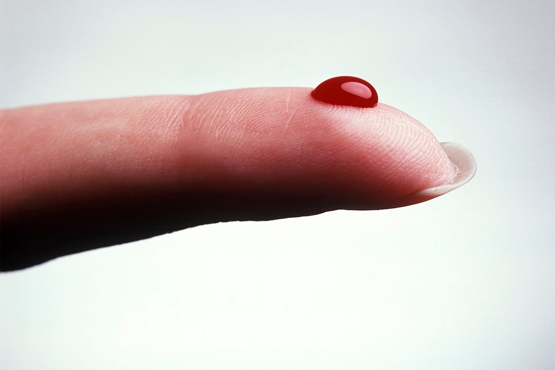 Photo of a pinprick