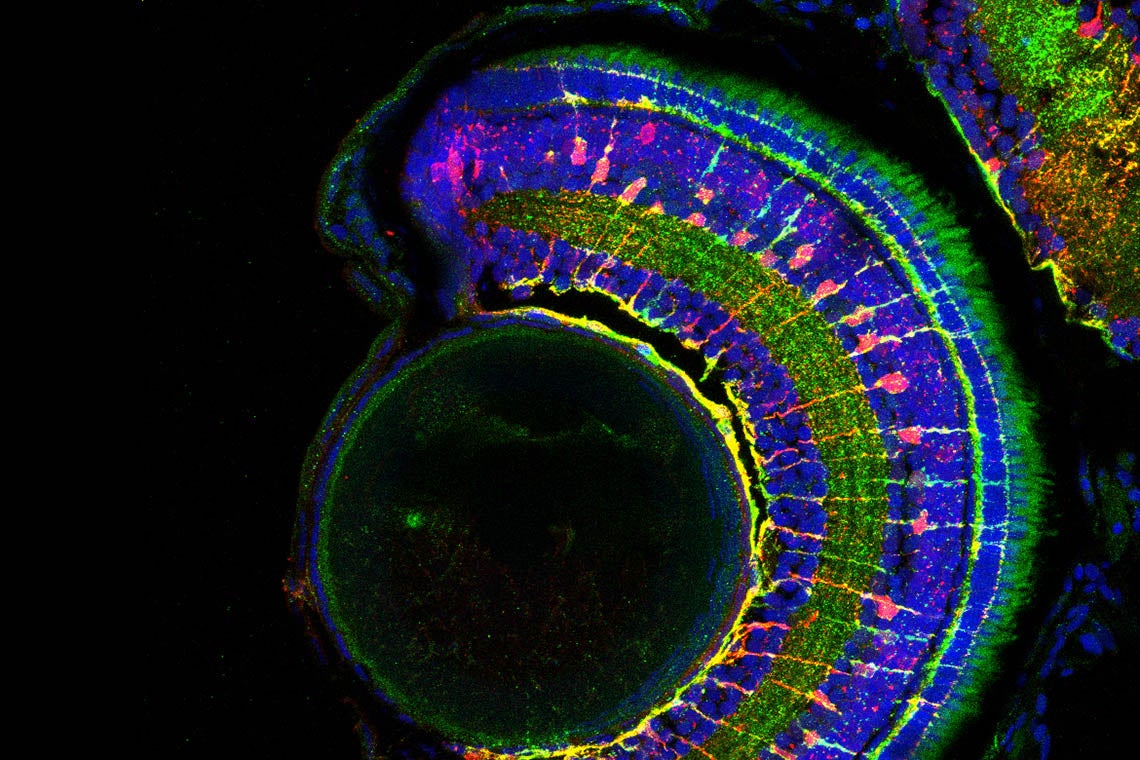 An image of a larval zebrafish retina