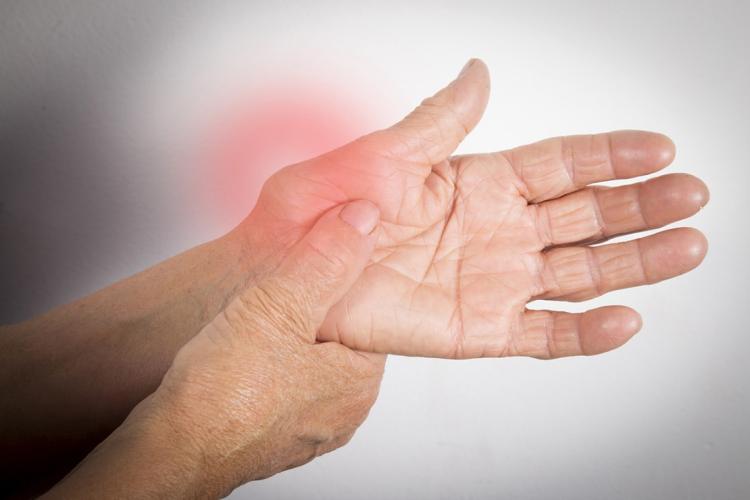 Photo of arthritic hands