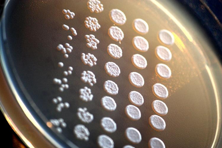 Photo of yeast cells