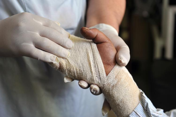 photo of latex-wearing hands holding the gauze-wrapped hand of a burn victim