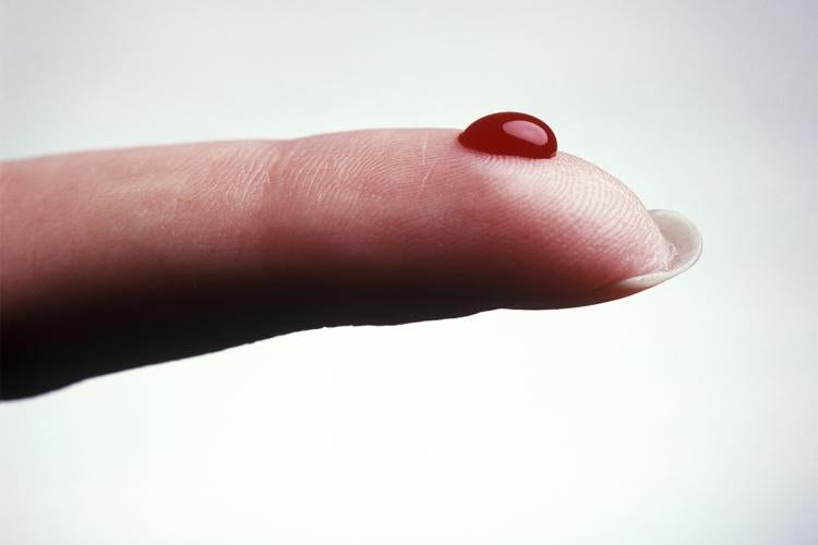 Photo of a pinprick