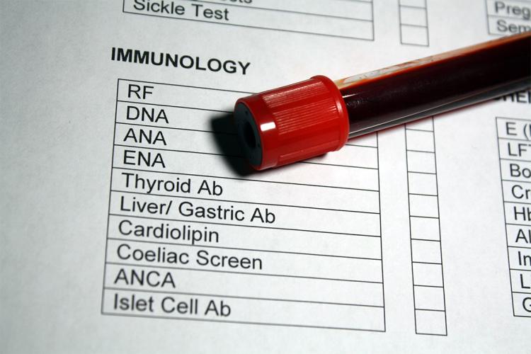 Vial of blood rests on a blood test requisition form