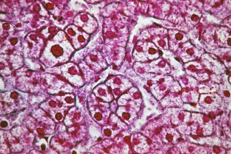 liver cells