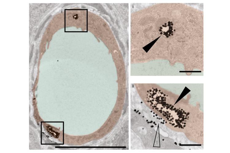 image showing nanoparticles being engulfed by endothelial cells