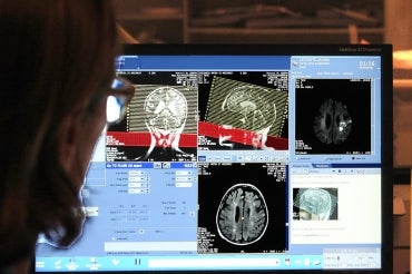 Photo of stroke imaging