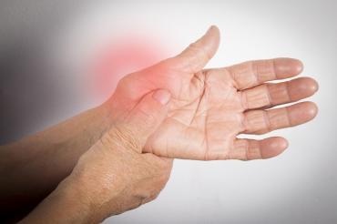 Photo of arthritic hands