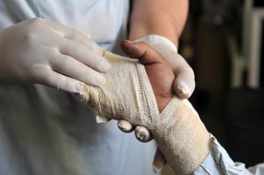 photo of latex-wearing hands holding the gauze-wrapped hand of a burn victim