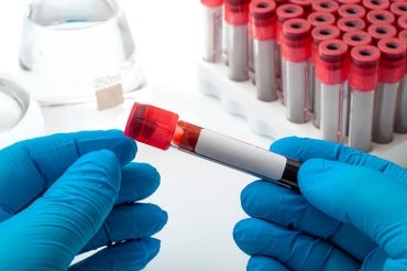 Gloved hands holding a vial of blood in a laboratory