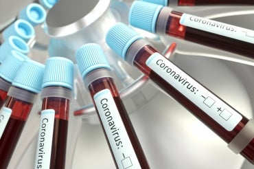 vials of blood in a centrifuge labelled coronavirus