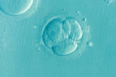 Human Embryo