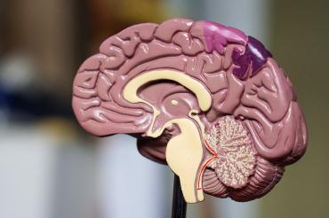 cross section of a brain showing the hippocampus